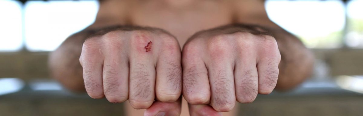 Bare-knuckle boxing is a bloodbath not fit for television audiences