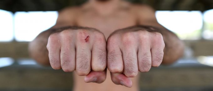 Bare-knuckle boxing is a bloodbath not fit for television audiences